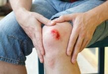 Tips Alami Menyembuhkan Luka Ringan dengan Bahan Tradisional