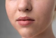 Terungkap! Penyebab Bibir Hitam yang Sering Tak Disadari & Solusi Alami Mengatasinya