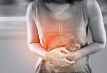 Warga RI Terancam Kanker Usus Besar, Dokter Bongkar Faktor Utama