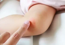 Tips Merawat Kulit Bayi Sensitif dengan Aman dan Efektif